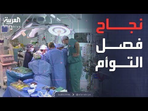 الرابعة | نجاح عملية فصل التوأم السوري في السعودية